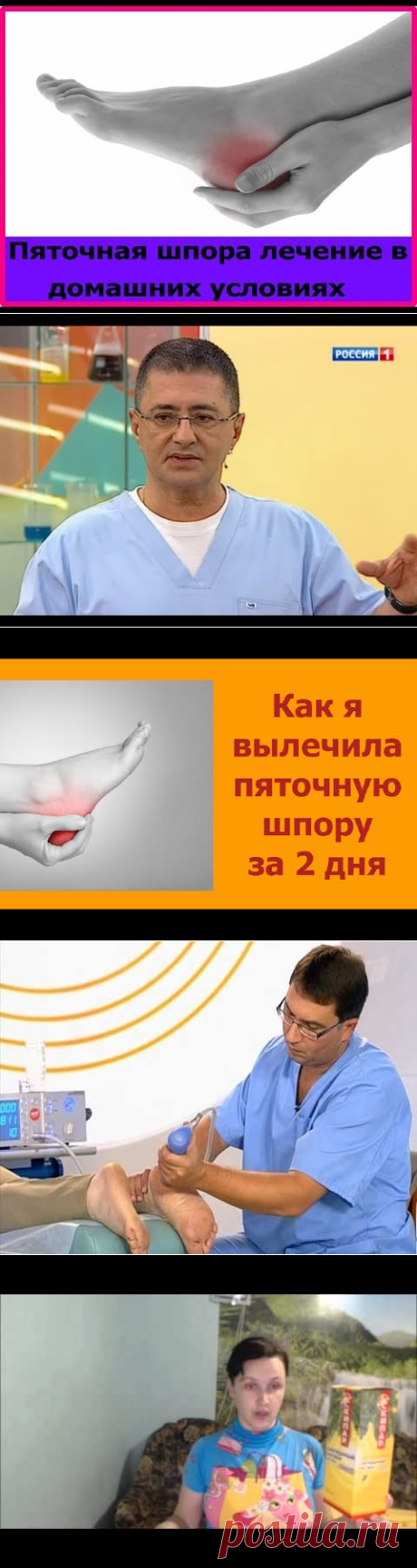 Пяточная шпора лечение в домашних условиях. Лечение пяточной шпоры желчью - YouTube