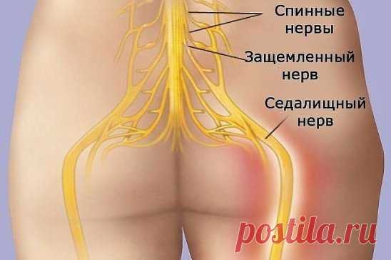 КАК РАЗБЛОКИРОВАТЬ СЕДАЛИЩНЫЙ НЕРВ
Как разблокировать седалищный нерв: 2 простых способа снять боль
Седалищный нерв свое начало берет в поясничном отделе позвоночника и, проходя через ягодицы, тянется к ступне. Поэтому боль при его защемлении чувствуется особенно сильно. 
Как правило, термин «защемление/ущемление седалищного нерва» подразумевает потерю эластичности и гибкости мышц задней поверхности ноги. Это часто связано с процессом возрастного укорочения (ригидности) мышц, который может начат
