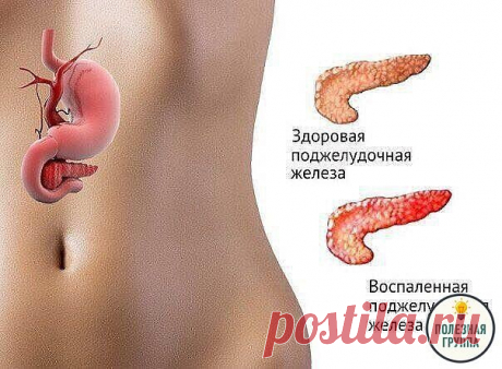Если беспокоит поджелудочная железа

Есть способ не только облегчить страдания, но и навсегда забыть о этой напасти….. Это семя льна…, оно единственное! способно вылечить вашу поджелудочную железу.

Нужно:

Свежемолотую столовую ложку семян льна заварить 0,5 стакана кипятка….

Дать потомиться на слабом огне 5 минут при закрытой крышке и оставить остывать в таком состоянии….. а тёпленьким, как остынет — выпить этот киселек вместе со всеми шелушками от семени за 30 минут до ...