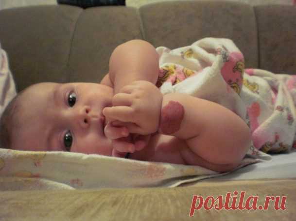 Что нужно знать про родимые пятна у детей Крупные родимые пятна, или невусы, часто наделяли мистическим значением: считалось, что такую метку на лице или теле оставляют злые силы, поэтому с «меченым» человеком лучше не связываться.