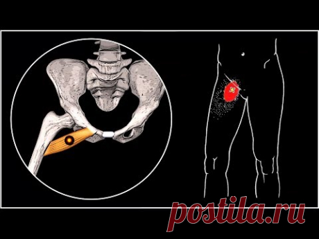 БОЛИТ ПАХ И БЕДРО 🔴 Гребенчатая мышца и миофасциальный болевой синдром ⭐ SLAVYOGA