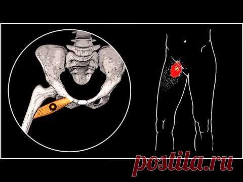 БОЛИТ ПАХ И БЕДРО 🔴 Гребенчатая мышца и миофасциальный болевой синдром ⭐ SLAVYOGA