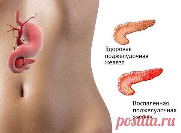 Семя льна - помощь поджелудочной железе Если беспокоит поджелудочная железа, вам поможет облегчить ваши страдания все один ингредиент, это семя льна.
 




Что вам необходимо:Столовую ложку семян льна перемолоть и заварить 0,5 стакана кипят…
