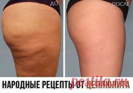 Избавляемся от целлюлита!.