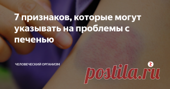 7 признаков, которые могут указывать на проблемы с печенью Симптомы заболевания печени, которые вы должны знать
Нормально ли функционирует ваша печень? Узнайте о 7 симптомах, которые могут указывать на проблемы с печенью.
Самый большой орган в организме, печень отвечает за переваривание липидов, углеводов и белков; для фильтрации крови для удаления токсичных веществ, лекарств и х