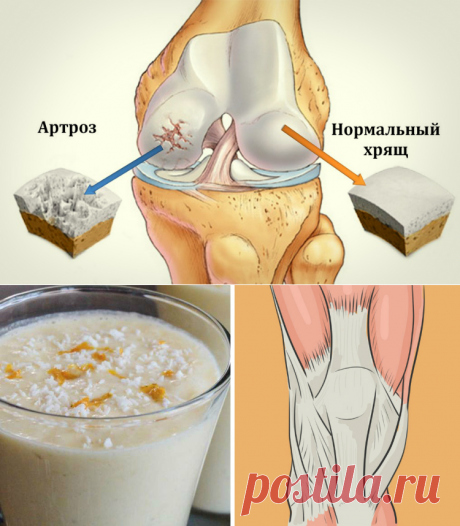 Как укрепить суставы