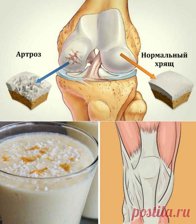 Этот простой и вкусный домашний напиток вернет молодость вашим суставам