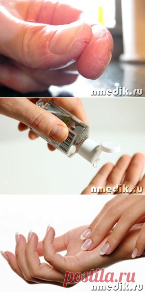 КАК ВЫЛЕЧИТЬ ТРЕЩИНЫ НА ПАЛЬЦАХ РУК.