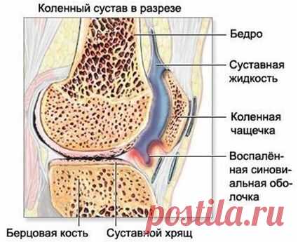 Боль в коленном суставе: причины, симптомы, лечение