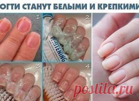 Чтобы ногти всегда выглядели ухоженными и были белыми,