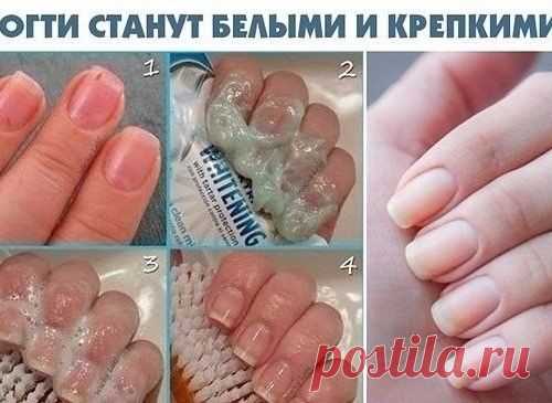 Чтобы ногти всегда выглядели ухоженными и были белыми,