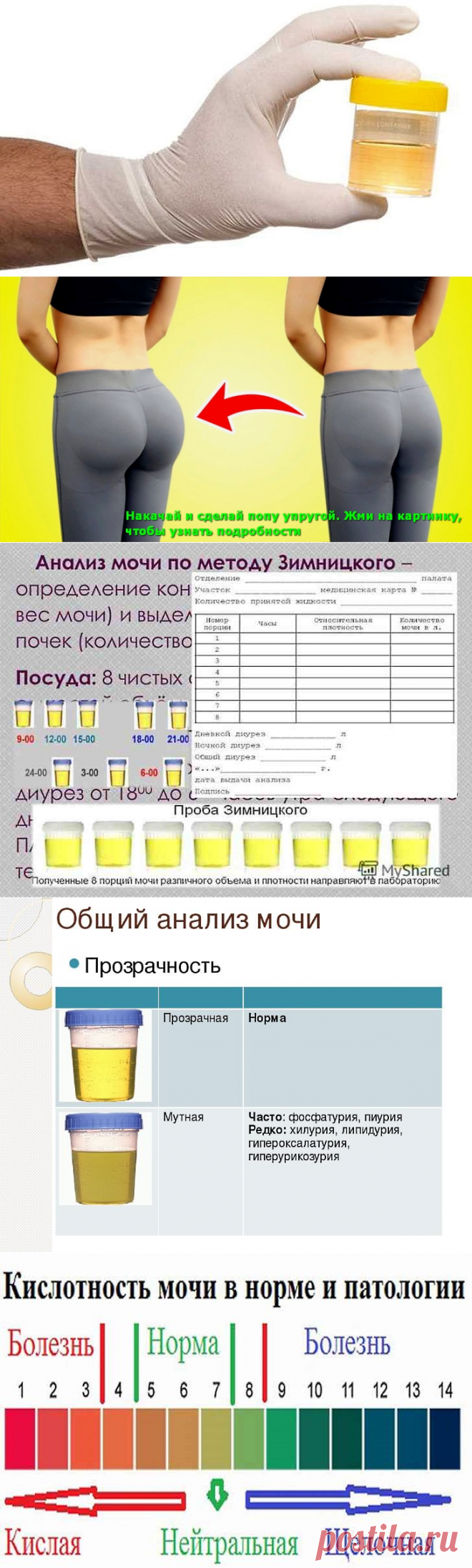 Анализ мочи норма и расшифровка результатов таблица у взрослых