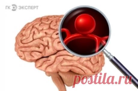 «Бомба замедленного действия». Говорим об аневризме сосудов головного мозга Это заболевание может протекать бессимптомно. И может осложняться кровоизлиянием в мозг.
Об аневризме сосудов головного мозга мы побеседовали с врачом-нейрохирургом «Клиника Эксперт» Воронеж Владимиром Абрамовичем Табачниковым.