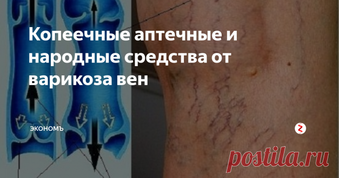 Копеечные аптечные и народные средства от варикоза вен Нельзя закрывать глаза на эту страшную болезнь, варикоз это нарушение циркуляции крови, которое в свою очередь приводит к более тяжелым последствиям!