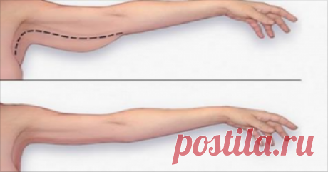 Лучшие упражнения для «обезжиривания» рук дома Смотрите видео и начните занятия уже сегодня!