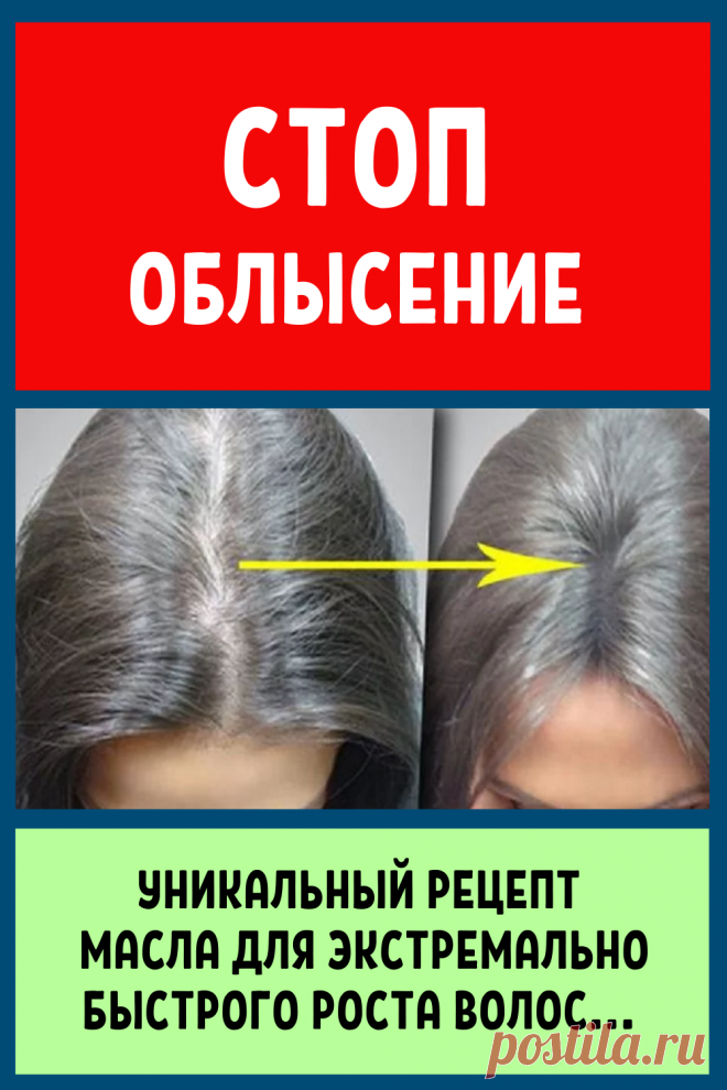 Стоп облысение: уникальный рецепт масла для экстремально быстрого роста волос...