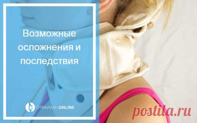 Вывих шеи🔎 - диагностирование травмы, симптомы и лечение