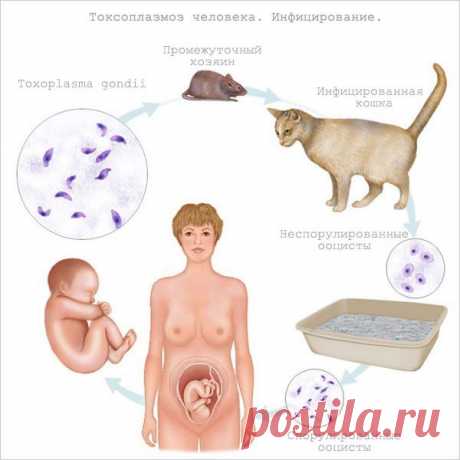 Токсоплазмоз - симптомы, формы и лечение, токсоплазмоз при беременности