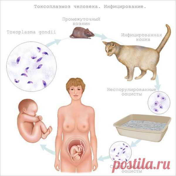 Токсоплазмоз - симптомы, формы и лечение, токсоплазмоз при беременности