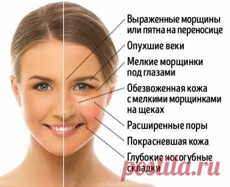 Какие продукты до неузнаваемости меняют лицо | Всегда в форме!