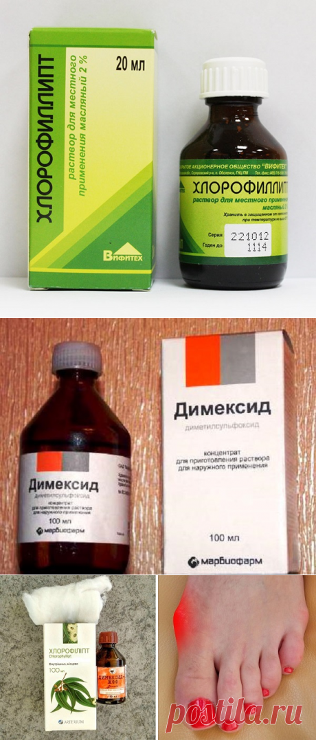 Косточка больше не болит!  2 средства, а эффект невероятен!