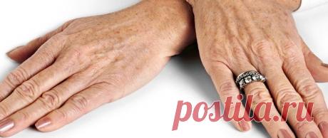 Как удалить пигментные пятна на руках — Полезные советы