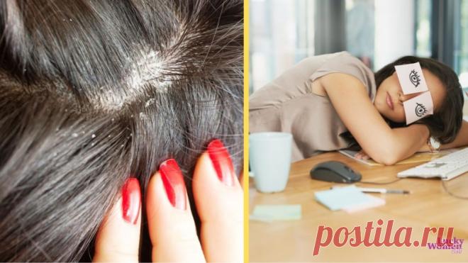 10 признаков, которые говорят, что организму не хватает витаминов — Домашние заботы