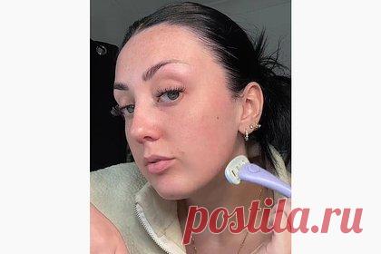 Женщину смутила собственная внешность через два месяца после бритья лица. Блогершу Шантель (фамилия неизвестна) смутила собственная внешность через два месяца после бритья лица. Сначала на размещенных кадрах инфлюэнсерша удалила бакенбарды с помощью бритвенного станка. По ее словам, растительность на лице в упомянутой зоне была причиной ее неуверенности в себе.