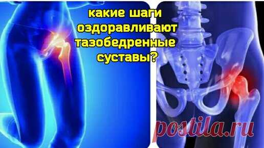 Как восстановить тазобедренные суставы? Помогут 