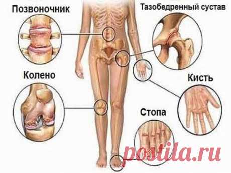 (47) Одноклассники    СОВЕТ  : Попрощайся с болью в суставах! 5 полезных советов