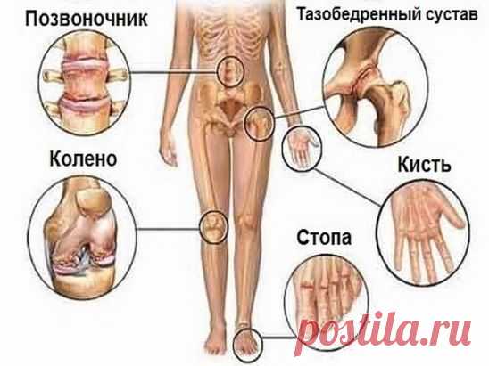 (47) Одноклассники    СОВЕТ  : Попрощайся с болью в суставах! 5 полезных советов