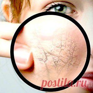 Увядающая кожа лица – уход, народные рецепты, маски для увядающей кожи лица