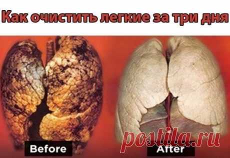 Как очистить легкие за три дня. 
Читать всем курильщикам! Проблемы с легкими характерны не только
для курильщиков. Киевляне, столкнувшиеся в эти дни с адским дымом, окутавшим весь город, смогли прочувствовать это на себе. И хотя любители табака – в особой группе риска, этот рецепт очищения легких подходит для всех. Его авторы гарантируют: очистить организм от никотина и смол таким образом можно в