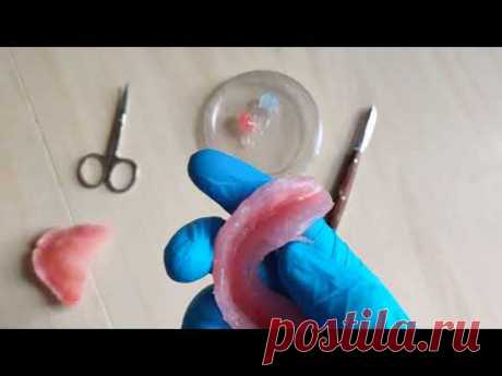 Силиконовая прокладка съёмного протеза? Набор для дома!