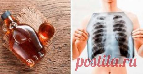 Сироп который очистит легкие, сосуды, предотвратит болезнь Альцгеймера, диабет, инсульт и улучшит кровообращение.  Если вы хотите очистить свое тело, особенно лёгкие, то мы рекомендуем использовать этот натуральный сироп!


Люди ошибаются, думая, что только курильщикам необходимо очищать свои легкие из-за высоког…