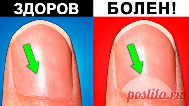 5 простых тестов, которые покажут, что ты болен!