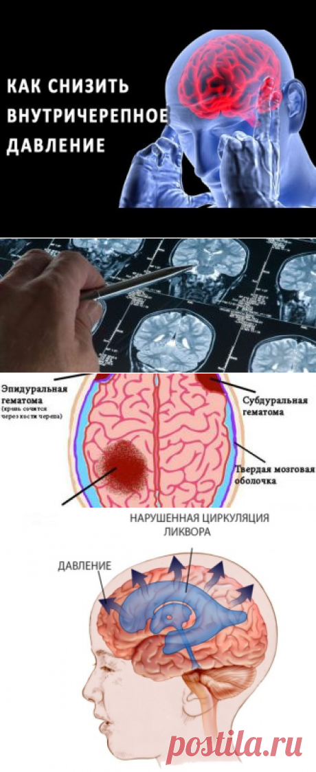 Как измерить внутричерепное давление в домашних условиях