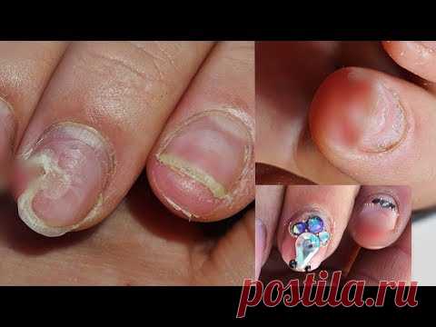 Я БЕЗМОЗГЛАЯ КУРИЦА🤦‍♀️