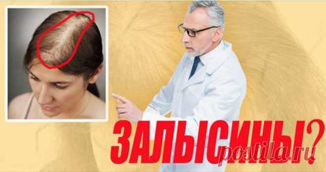 Залысины? Врач показал домашний способ, как сделать волосы густыми за 7 дней! Всего 4 ингредиента.