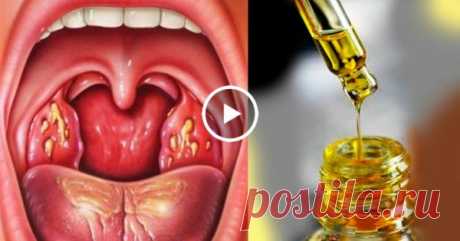 У вас часто болит горло, пропадает голос и мучает кашель? Избавься от этих проблем за 1 ночь, просто и легко! — Копилочка полезных советов