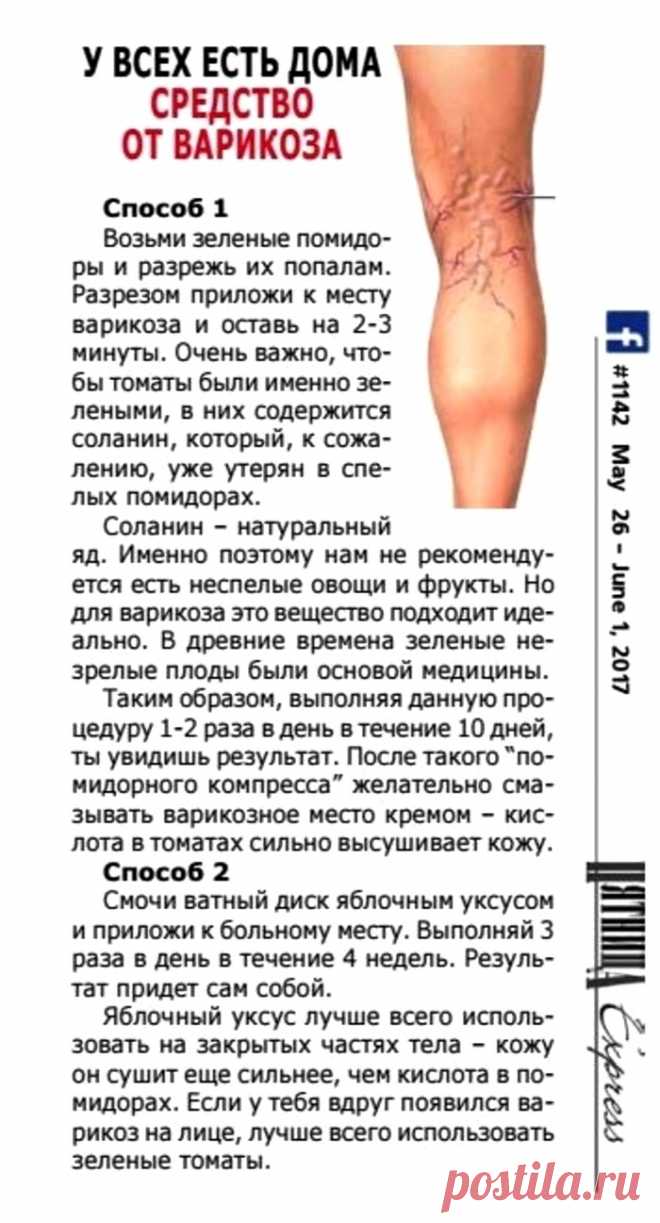 У всех есть дома средство от варикоза