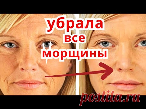 Вы будете поражены Результатом! Маска от Морщин Омоложение Лица/ Рецепт