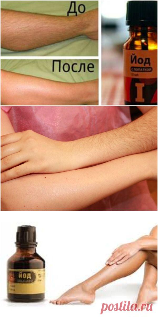 Как с помощью йода избавиться от нежелательных волос на теле: 2 рецепта