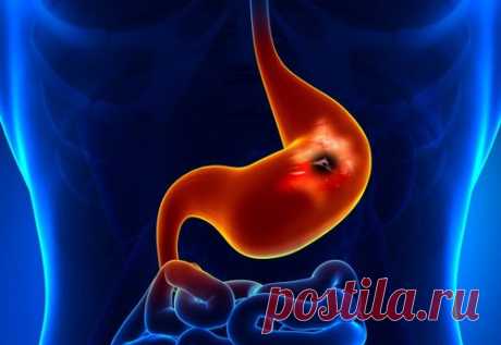 Síntomas de una posible úlcera gastroduodenal: ¡Conócelos! - Mejor Con Salud