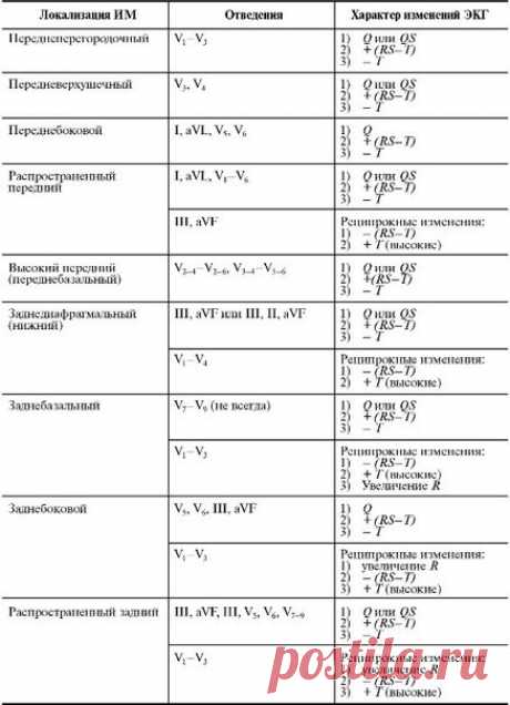 Измeнeниe ЭΚΓ пpи ocтpoм ИΜ paзличнoй лoкaлизaции