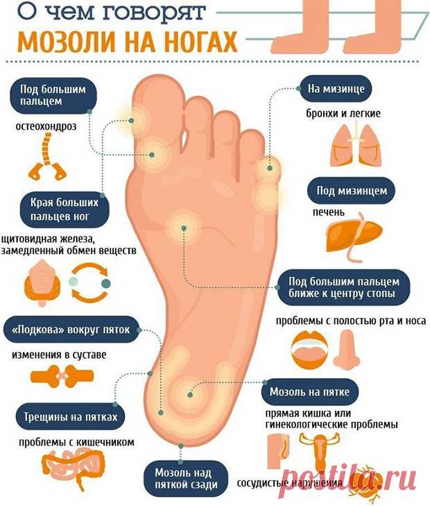Сухая мозоль на пальце ноги со стержнем: лечение, как лечить и вывести