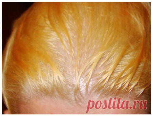 Желтый цвет волос у девушки после осветления: видео-инструкция - убрать, избавиться от пигмента своими руками, как получить, добиться белого оттенка прядей без желтизны, почему желтеют крашенные локоны, чем закрасить, осветлить, фото и цена