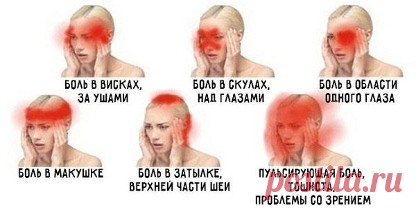 О чем говорит боль в разных частях головы