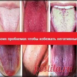Язык — зеркало организма. Узнайте о своих проблемах, чтобы избежать негативных последствий