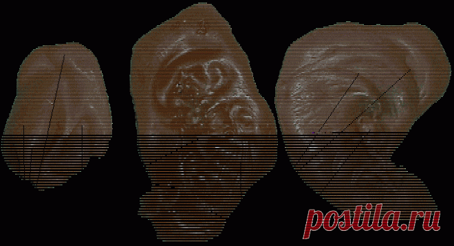 Отливки на воск: Испуг, Сглаз, Переживания, Остатки порчи